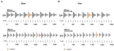 Neural mechanisms of temporal and rhythmic structure processing in non-musicians